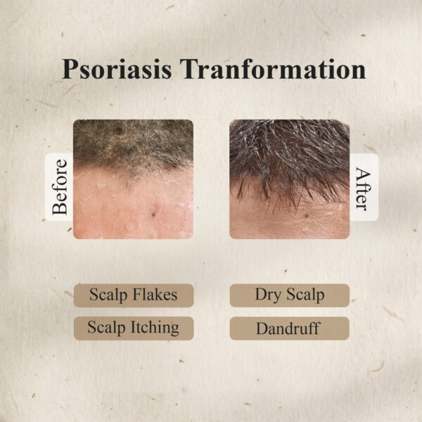 Sri Bhaskara Kumkumadi Tailam (25 ml)