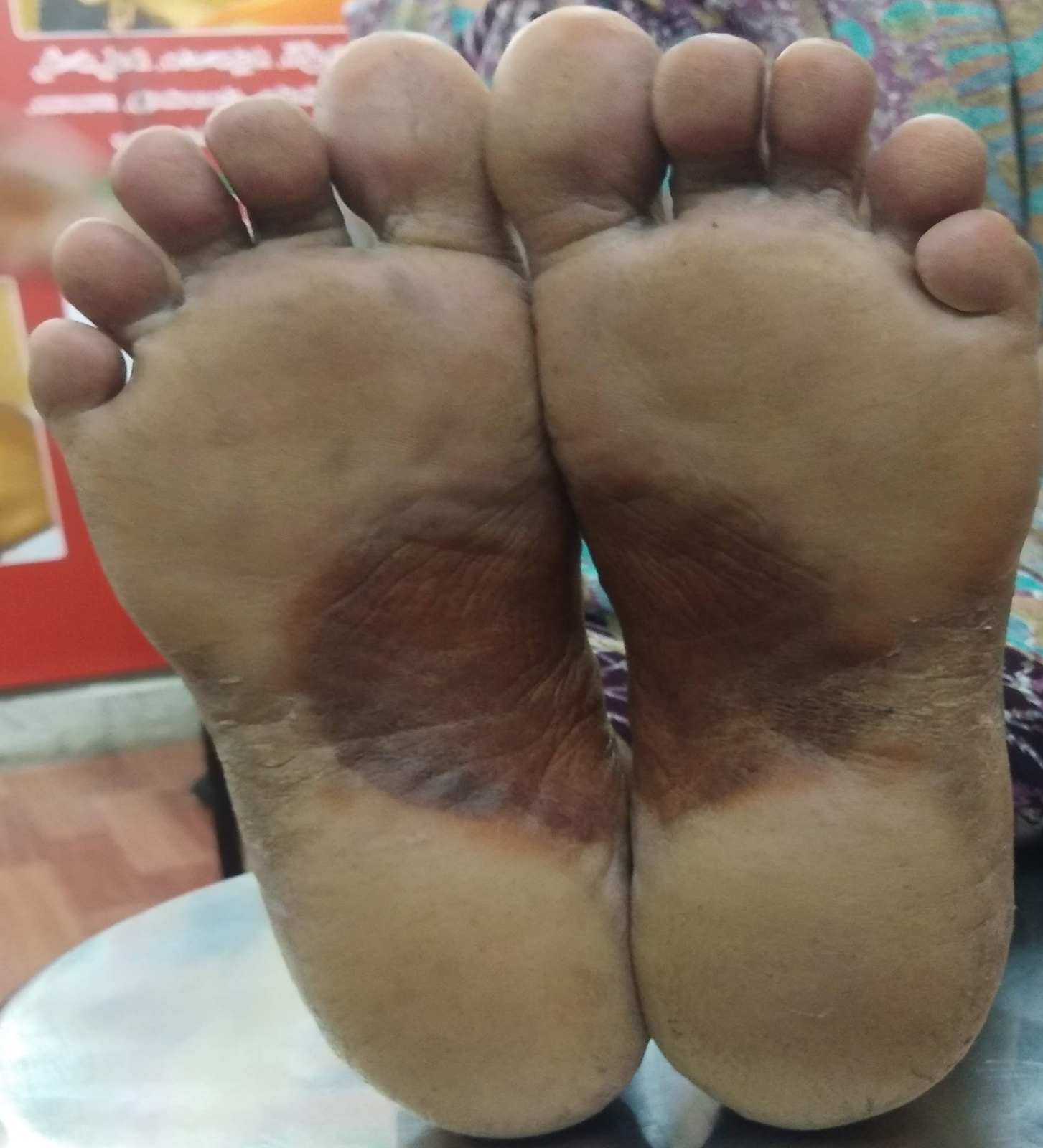 Foot_A.jpg