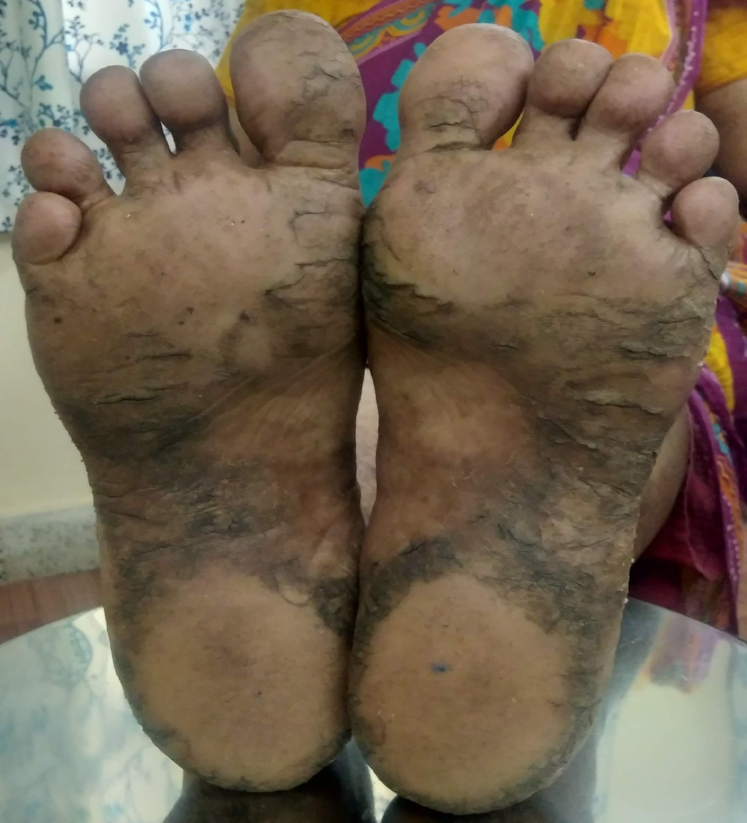 Foot_B.jpg