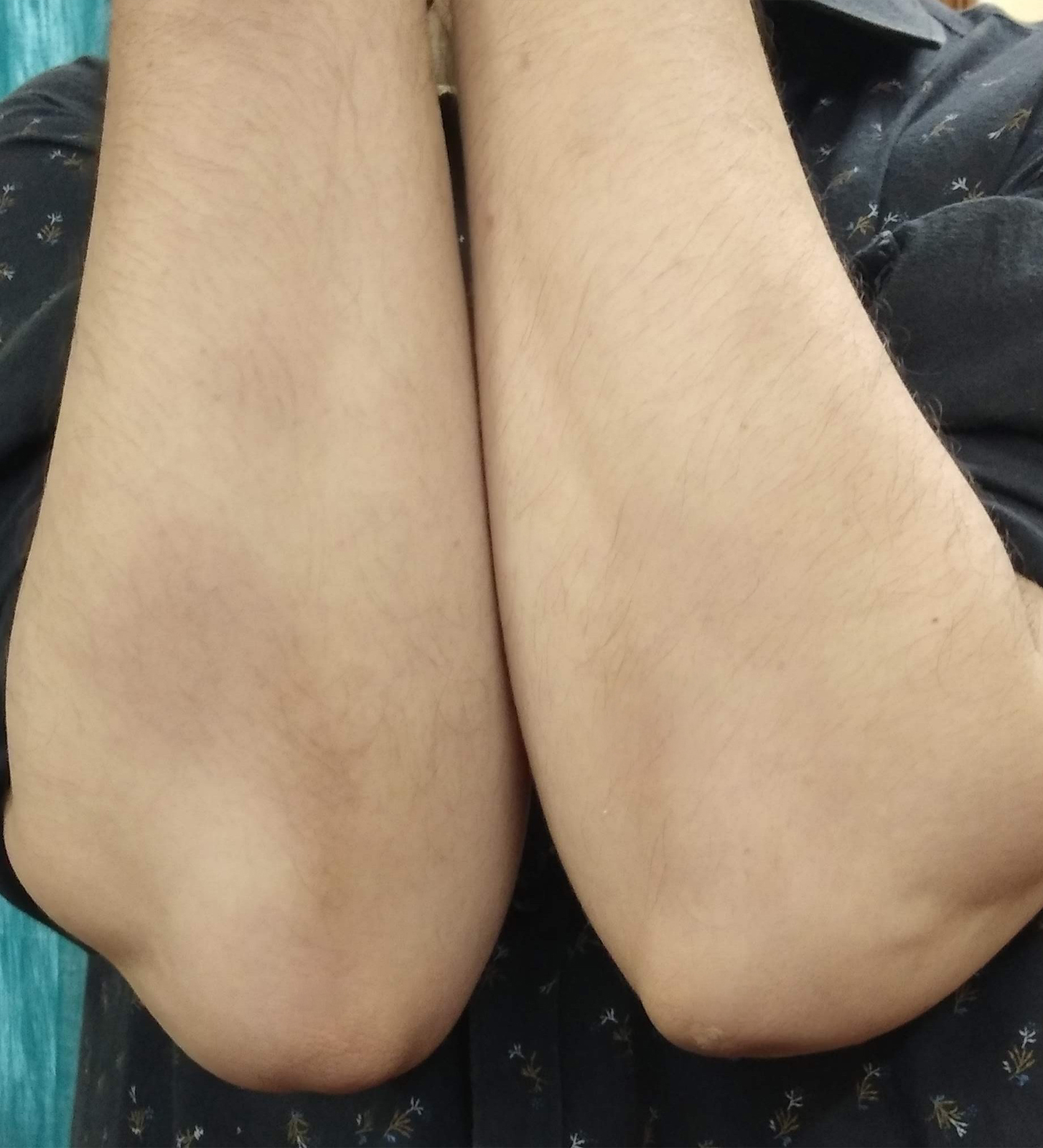 Hand_A.jpg