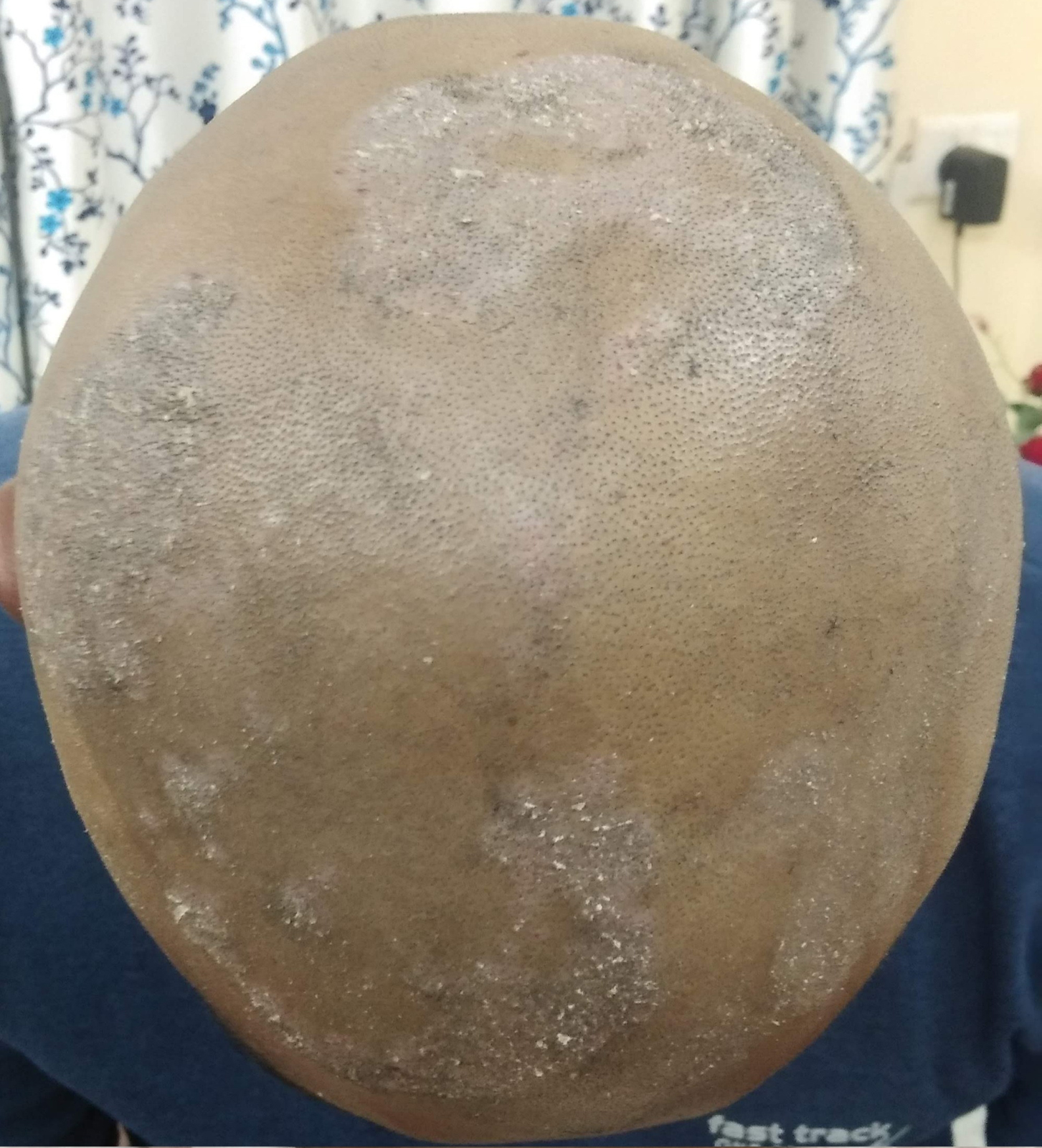 Head_B_1.jpg