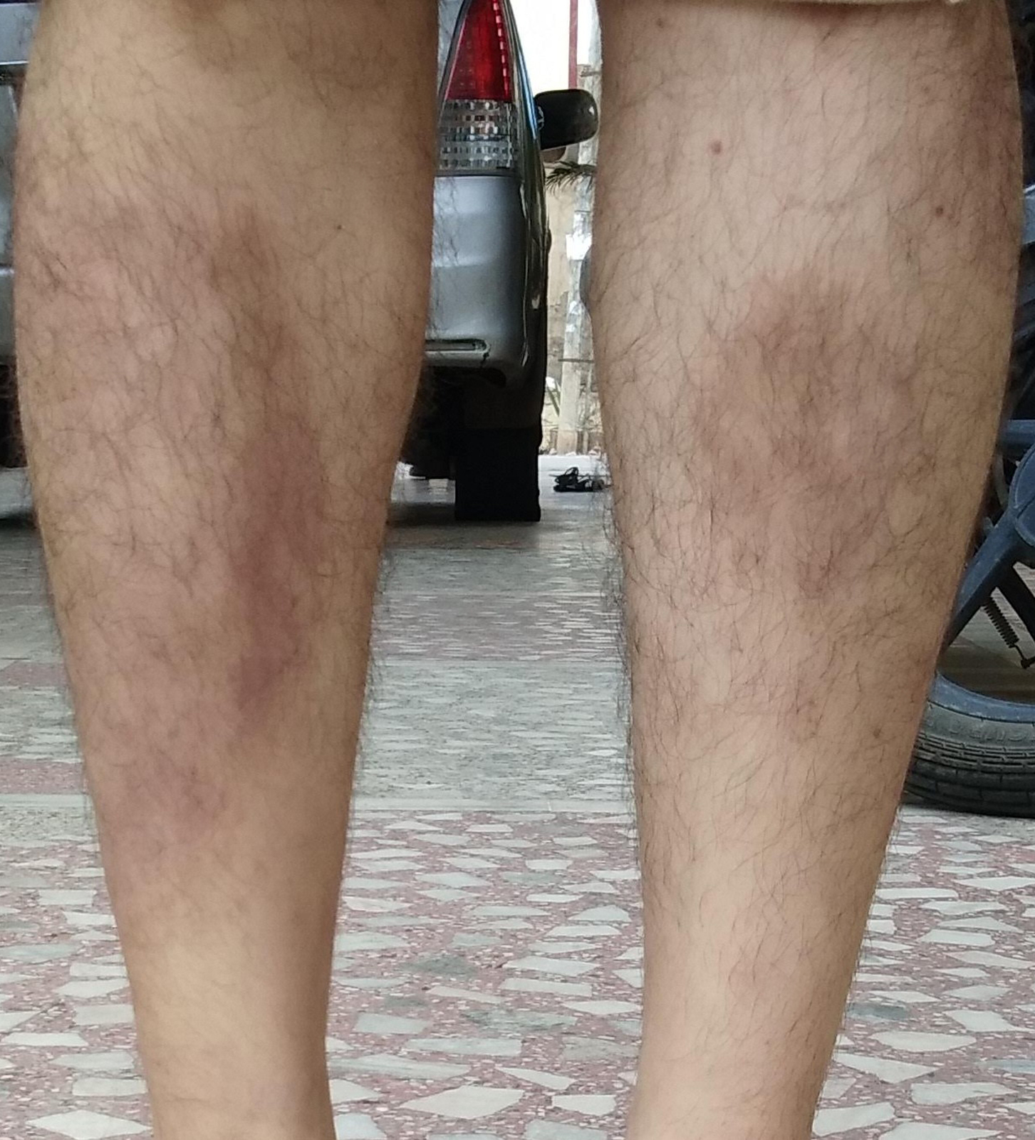 Leg_A.jpg