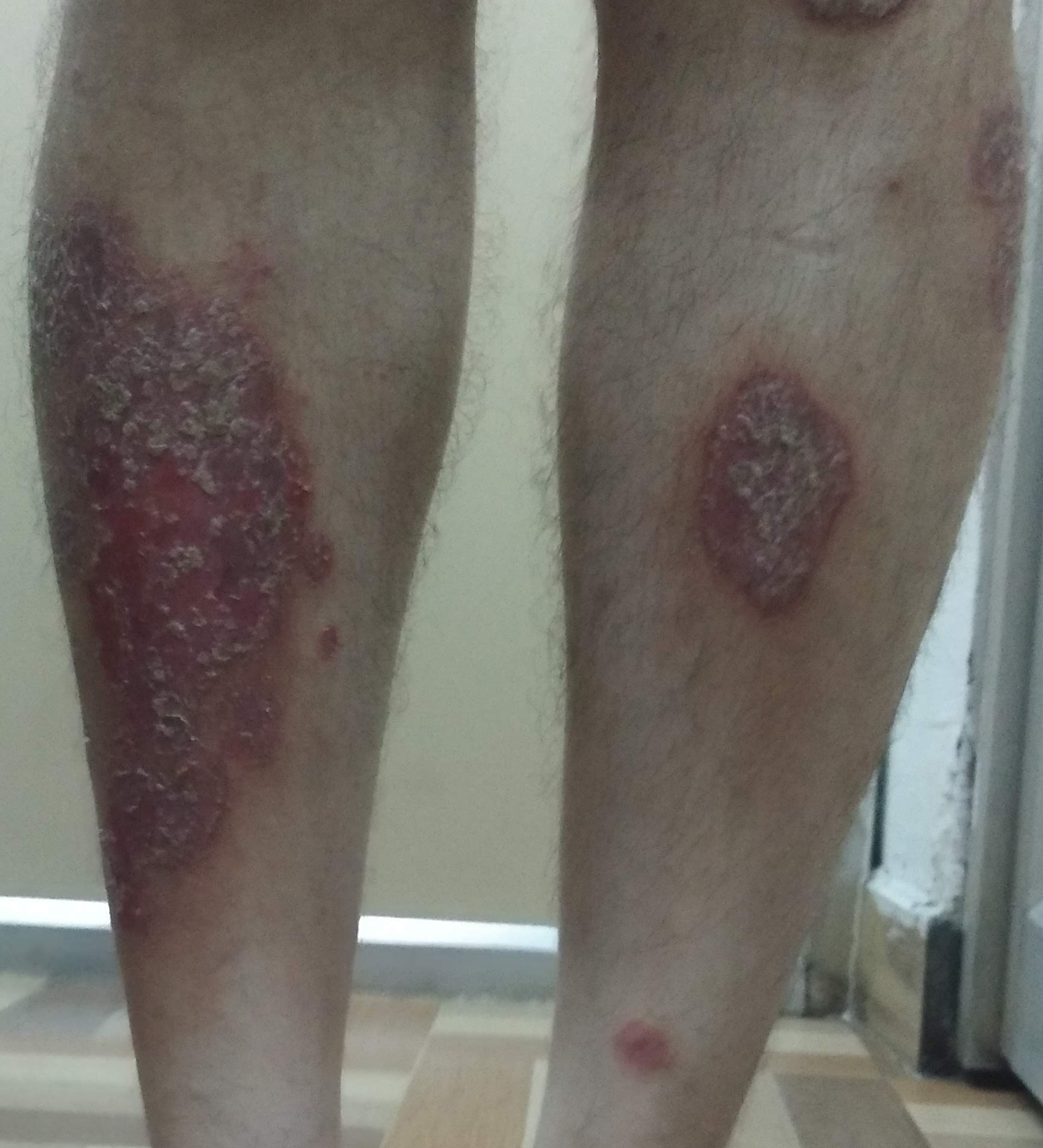 Leg_B.jpg