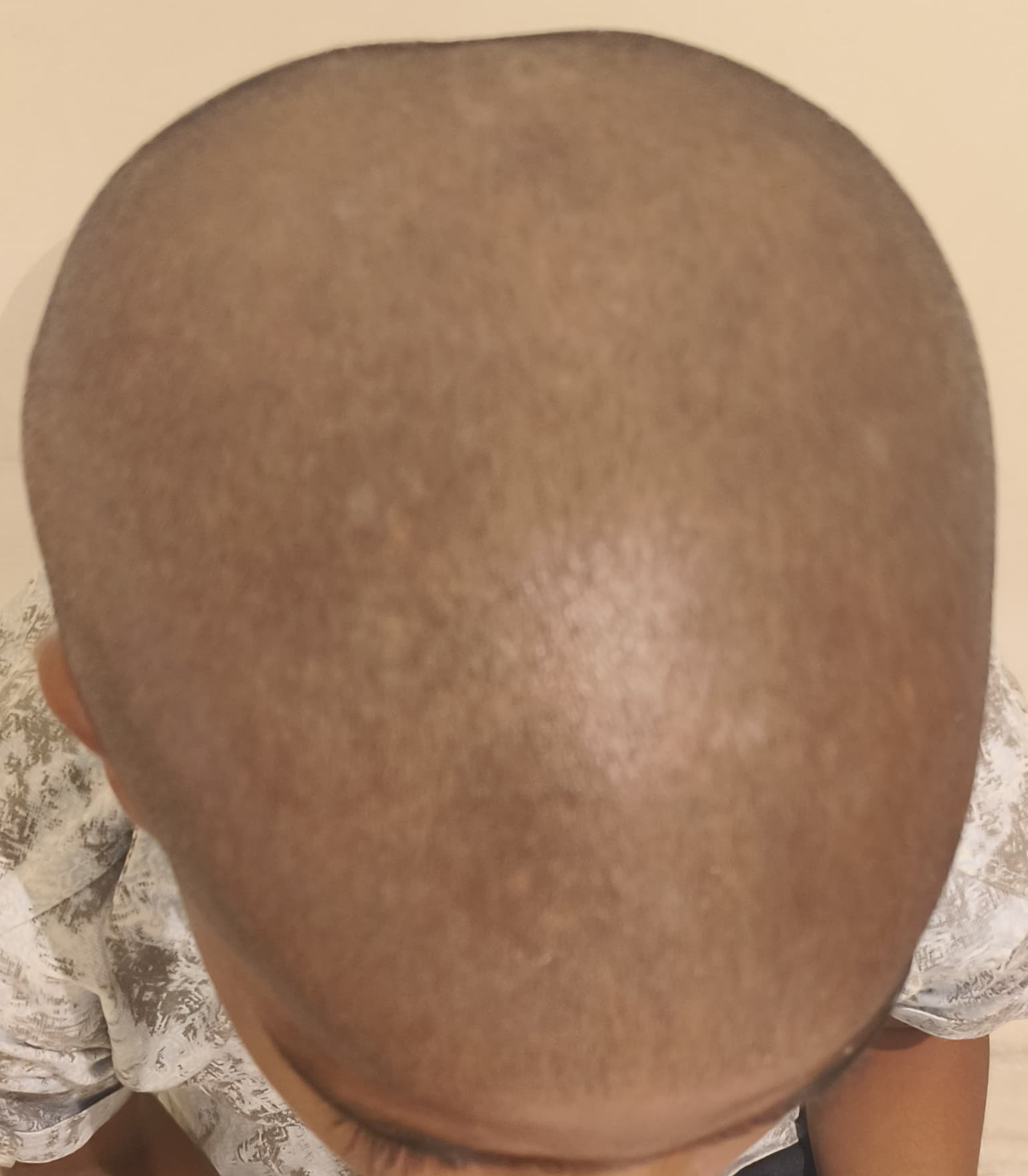 A.jpg
